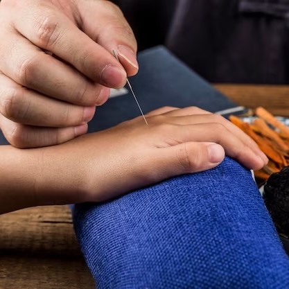 Acupuncture: Ancient Wisdom Meets Modern Science